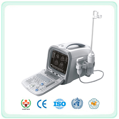 S6602 Portable Full Digital Diagnostic Ultrasound Machine